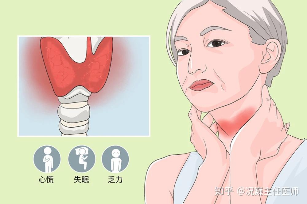 甲状腺创新疗法揭秘，前沿科技引领治疗新篇章